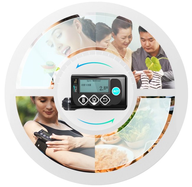 胰岛素泵价格是多少?