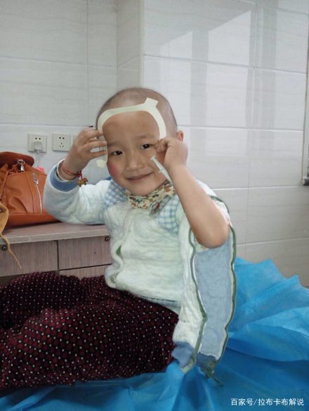 白血病海海还活着吗