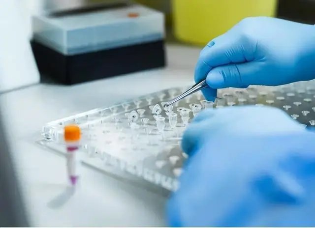 核酸试剂毛利高吗