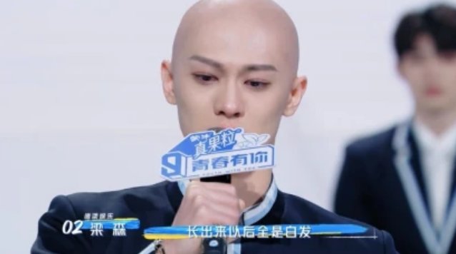 梁森头发怎么了？