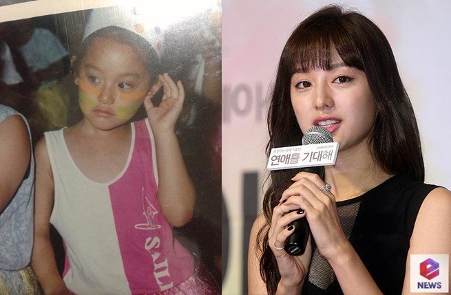 金智媛整容了吗