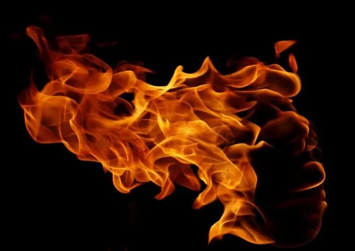 郑州孩子玩耍引燃不明液体严重烧伤，此事件后续情况如何？